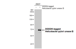 Anti-Helicobacter pylori urease B antibody [HL4569] used in Western Blot (WB). GTX644245